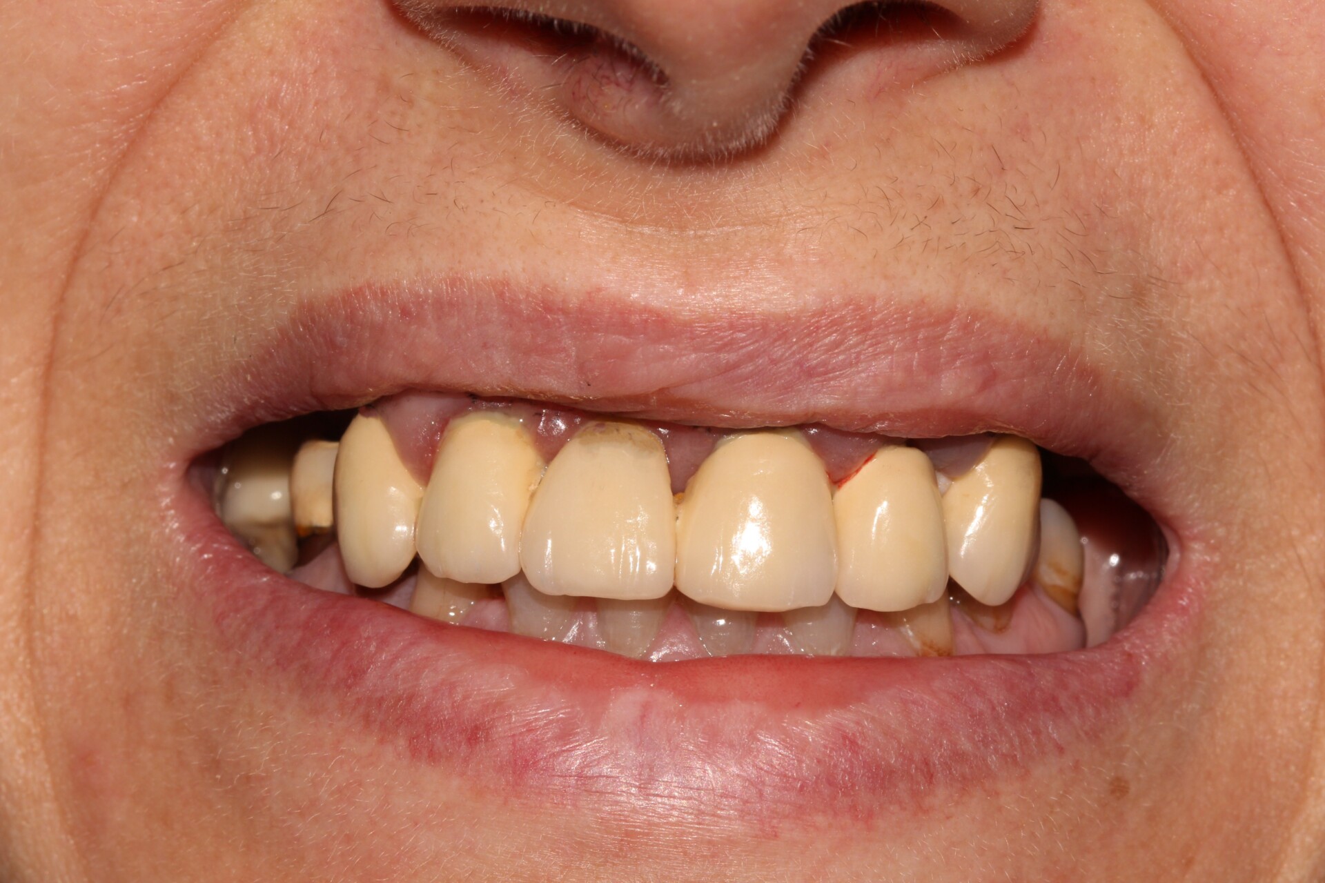 metamorfoza allon4 3