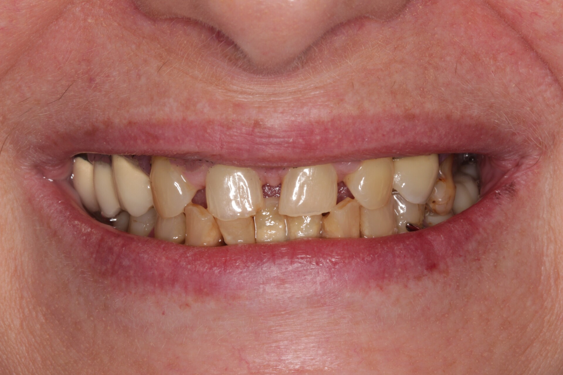 metamorfoza_allon4_1