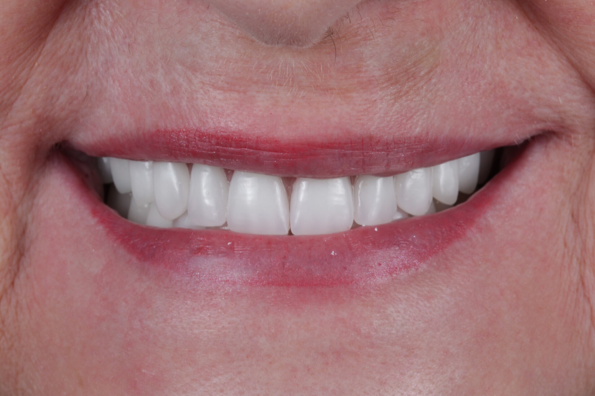 metamorfoza_allon4_2..